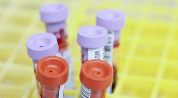 Tissue sample tubes in a laboratory